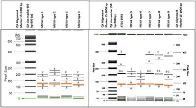 Molecular diversity of Paenibacillus larvae strains isolated from Lithuanian apiaries